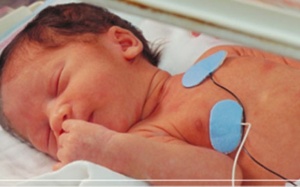 Các dị tật bẩm sinh thường gặp ở trẻ