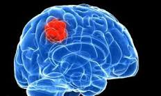 Kiếm hàng ngàn USD nhờ ung thư giả