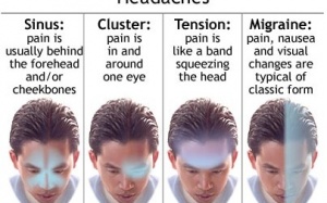 Bệnh đau đầu: Những điều cần biết