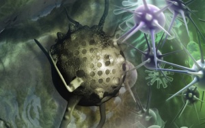 Khối u cũng sẽ được… in 3D