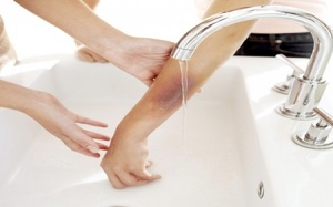 Video: Cách xử trí khi người thân bị nghẹn, bị bỏng và chảy máu 