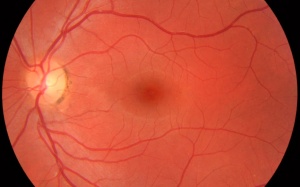 Khám mắt, bắt bệnh não