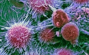 Hầu hết các ca ung thư là do… đen đủi!