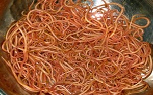 Bác sỹ kinh hãi gắp hơn 300 con giun trong bụng bệnh nhi 3 tuổi