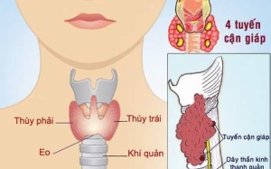 Bệnh thường gặp ở tuyến giáp