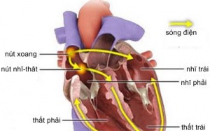 Điều trị rối loạn chức năng nút xoang như thế nào?