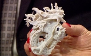 Bé gái 2 tuổi thoát chết nhờ trái tim được in 3D