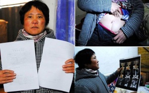 Bác sỹ Trung Quốc ăn cắp thận của người bệnh