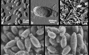 Khi vi khuẩn 'gặm'... khối u