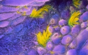 Nguy cơ ung thư từ liệu pháp thay thế hormone