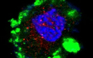 Lợi khuẩn probiotic hạn chế đái tháo đường