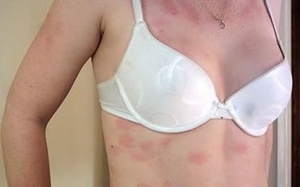 Những triệu chứng bệnh lạ đời “không thể tin nổi'