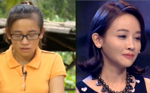 Các cô gái Việt “hoá thiên nga” sau phẫu thuật thẩm mỹ