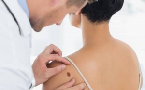 Ngày càng nhiều phụ nữ châu Á bị ung thư da