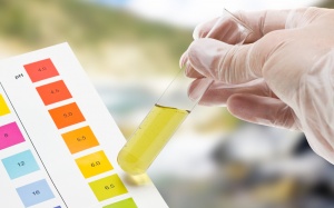 Chẩn đoán ung thư thận qua... nước tiểu