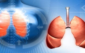 75 triệu người sẽ chết vào năm 2050 do lao kháng thuốc