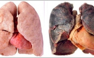 4 loại bệnh nào giết 15 vạn người Việt Nam mỗi năm?