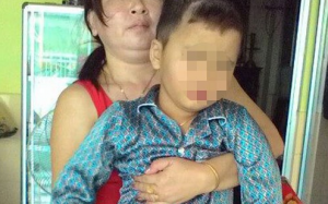Bác sỹ thờ ơ, bé trai bị cắt cụt chân: Bộ Y tế yêu cầu xác minh, xử lý