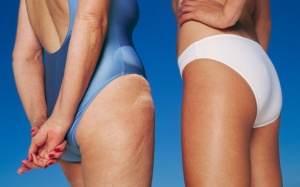 Photo: Cách làm mềm da sần vỏ cam