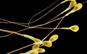 Tinh dịch màu vàng có bị vô sinh?