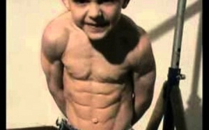 Sửng sốt với 5 căn bệnh cực hiếm trên thế giới