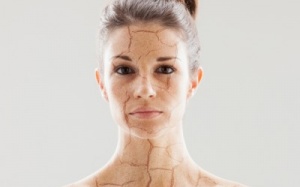 Infographic: Những lý do bất ngờ khiến da khô