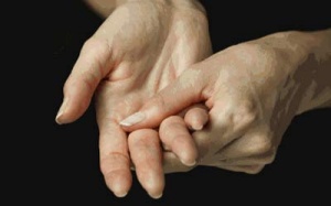 Viêm khớp dạng thấp: Không điều trị sẽ tàn phế