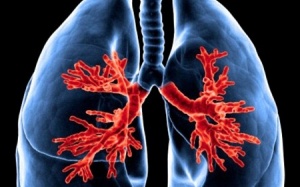 Phát hiện nguyên nhân mới gây bệnh hen suyễn