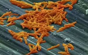 Dùng vi khuẩn không độc chống nhiễm trùng