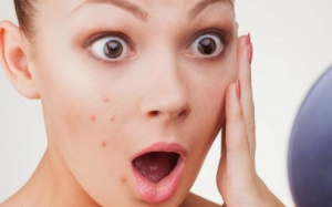 Video: 5 loại thực phẩm giúp phòng ngừa mụn trứng cá