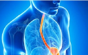 8 dấu hiệu cảnh báo bệnh viêm thực quản trào ngược