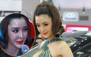 Hàng vạn người tàn phế vì giải phẫu thẩm mỹ