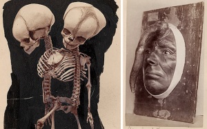 Những bức ảnh ấn tượng trong bảo tàng lịch sử Y học thế giới