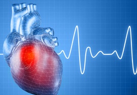 Rối loạn nhịp tim - Chớ coi thường!