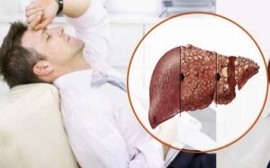 Cách phòng tránh ung thư cho người bị viêm gan B mạn tính