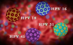 Yếu tố tăng nguy cơ ung thư cổ tử cung