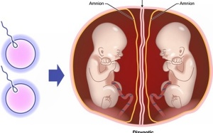 Nguy cơ sức khỏe mẹ và bé khi mang đa thai