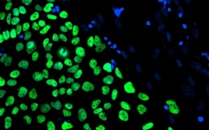 'Sửa chữa' cơ tim bằng tế bào gốc