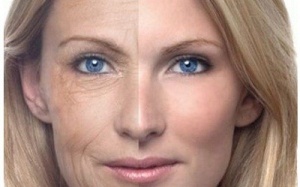 10 biện pháp chống da lão hóa