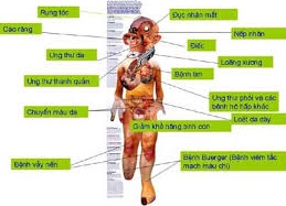 Gần 98% các bệnh ung thư phổi liên quan đến thuốc lá