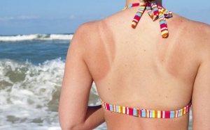 Video: Hướng dẫn làm 'kem' chữa trị cháy nắng tại nhà