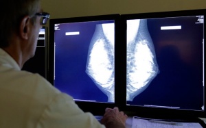 Phòng ung thư vú di căn sang xương chỉ với… 20.000 đồng