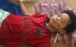 Bé trai 7 tuổi phải cắt bỏ 2/3 dạ dày do uống nhầm acid đựng trong chai la Vie