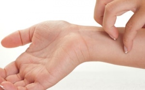 Nổi mẩn đỏ, ngứa khắp người vào mùa hè là bệnh gì?