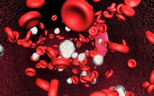 Suy tủy xương: Những điều cần biết