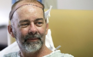 Ca ghép hộp sọ thành công đầu tiên trên thế giới