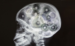 5 điều bất ngờ làm bạn trở lên trì độn