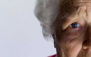 Cách nhận biết người thân mắc Alzheimer hay sa sút trí tuệ thể Lewy