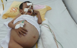 Xót xa những thân bệnh lay lắt chờ nguồn tạng hiến