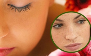 Nám da tuổi trung niên: Phải trị từ bên trong!